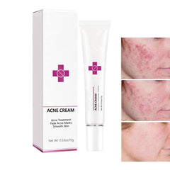 Onkessy front packaging showing product and clear instructions for quick use benefit