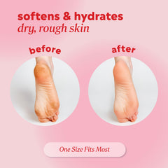 Onyx Professional socks worn during treatment for deep hydration