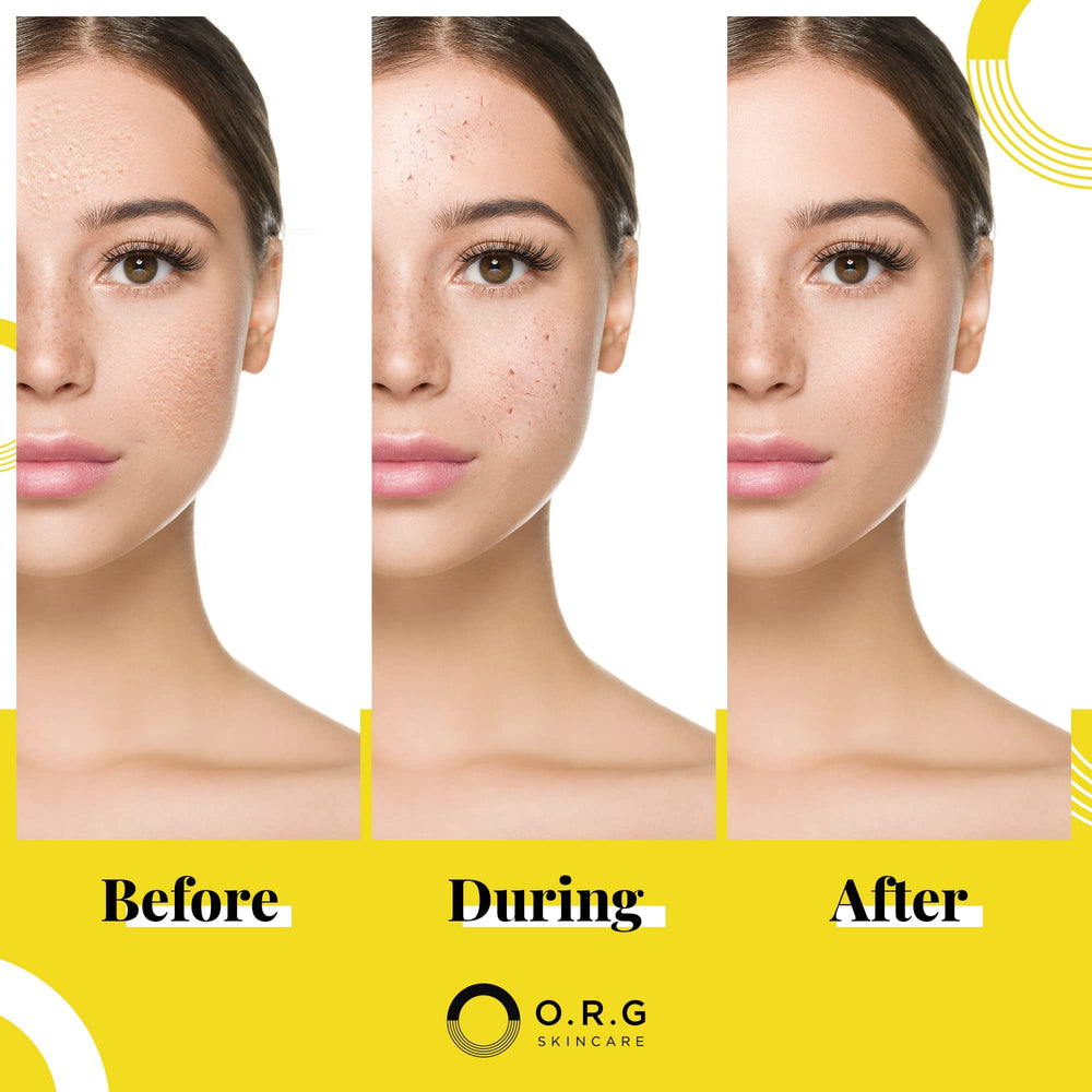O.R.G. Skincare tube beside jojoba and herbs highlighting natural extracts