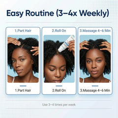 ORRÉNATURALS roll-on being applied to scalp for targeted comfort