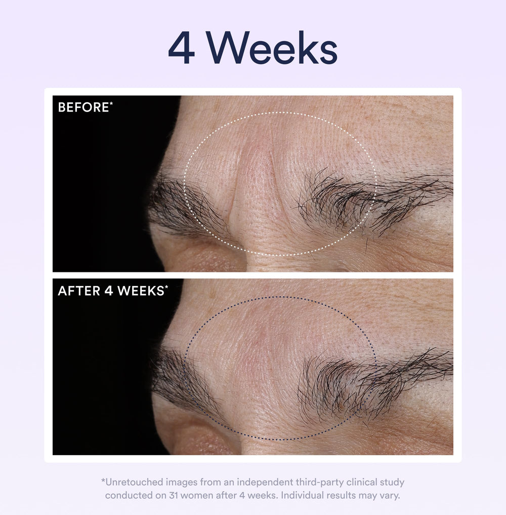 OSEA before and after visual suggesting improved texture and brightness