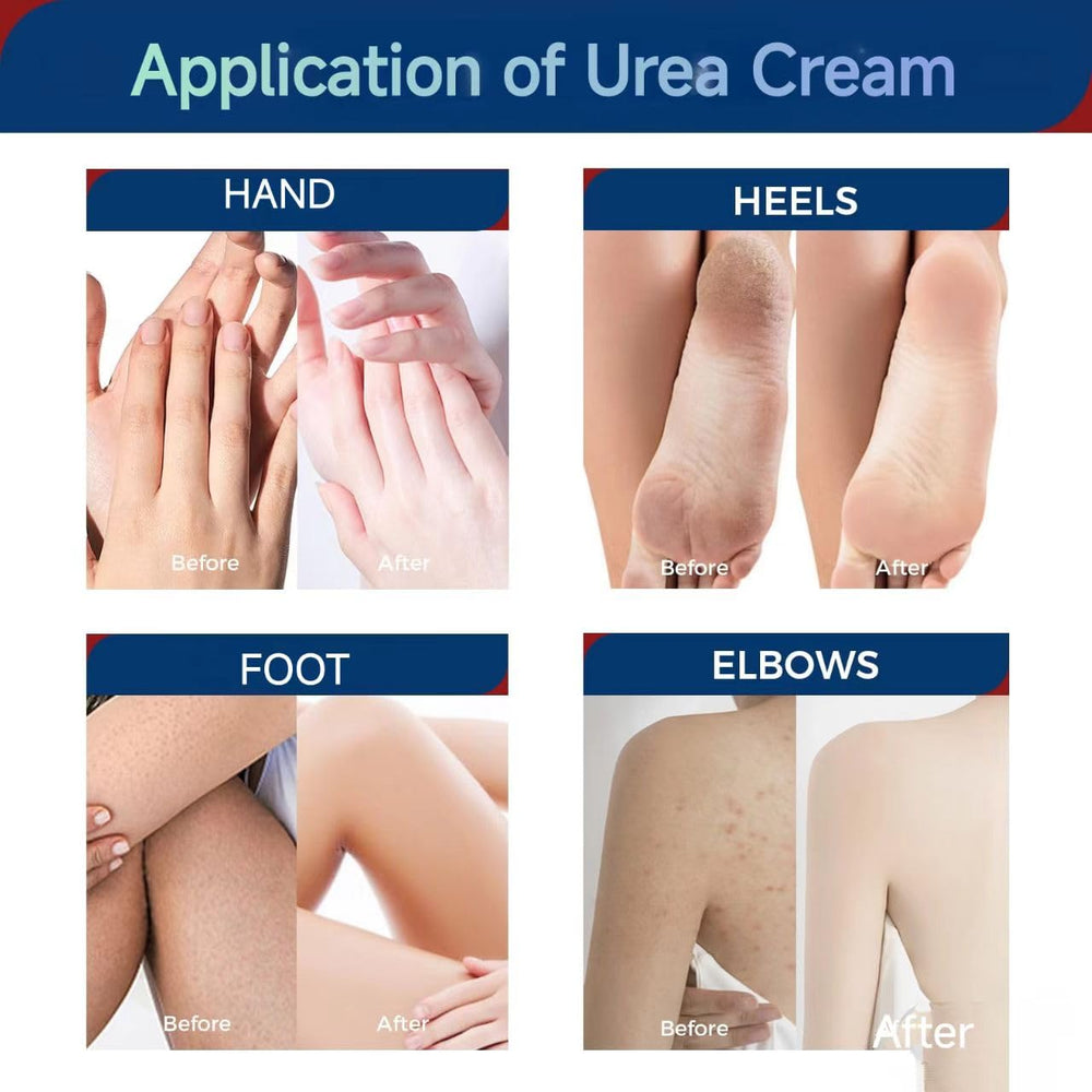 OUKEYA label close-up showing active urea and salicylic acid benefits