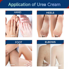 OUKEYA label close-up showing active urea and salicylic acid benefits