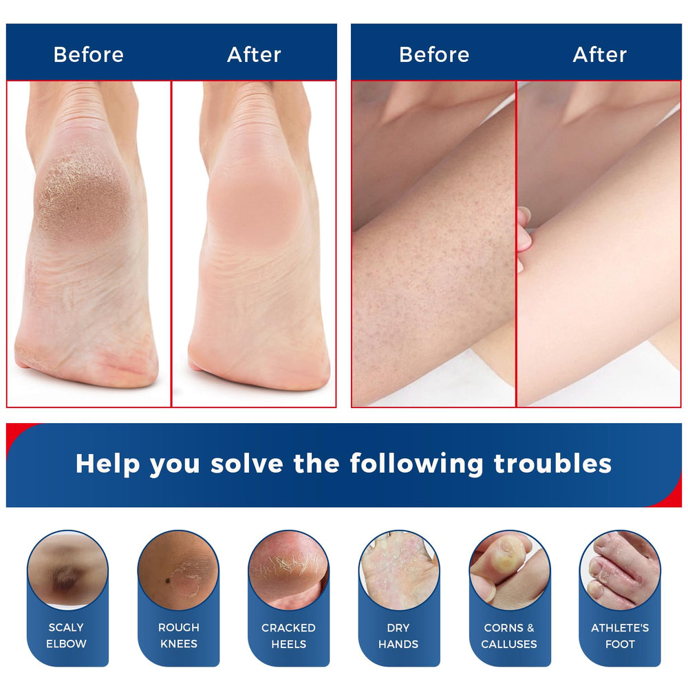 Hand demonstrating OUKEYA quick absorption to show non-greasy comfortable finish benefit