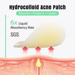 ourmed life close-up of hydrocolloid patch texture highlighting absorption