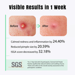 ourmed life patch applied on cheek overnight demonstrating protective use
