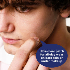PanOxyl patch applied to cheek demonstrating comfortable daytime wear