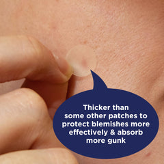 PanOxyl patch applied on skin overnight demonstrating discreet protection