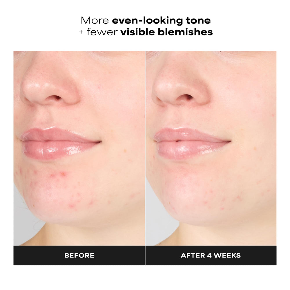 Paula's Choice gel texture close-up demonstrating lightweight hydration