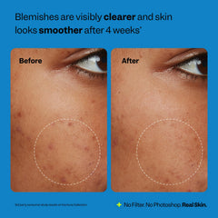 Peach Slices moisturizer being applied to face for balanced hydration