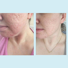Perfect Image peel bottle in bathroom setting suggesting at-home professional use