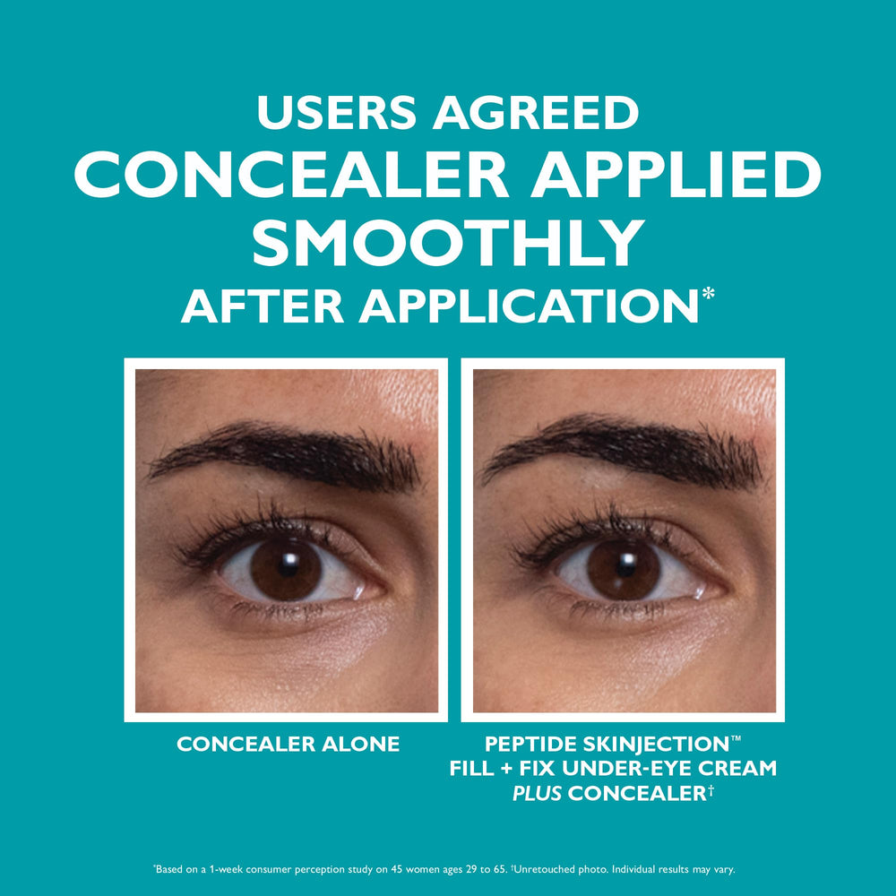 Peter Thomas Roth before and after under-eye comparison showing lifted look