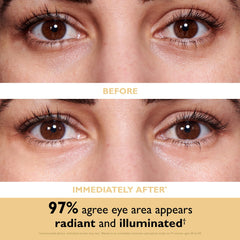 Peter Thomas Roth close-up of gold hydrogel eye patches showing smooth texture and luxury