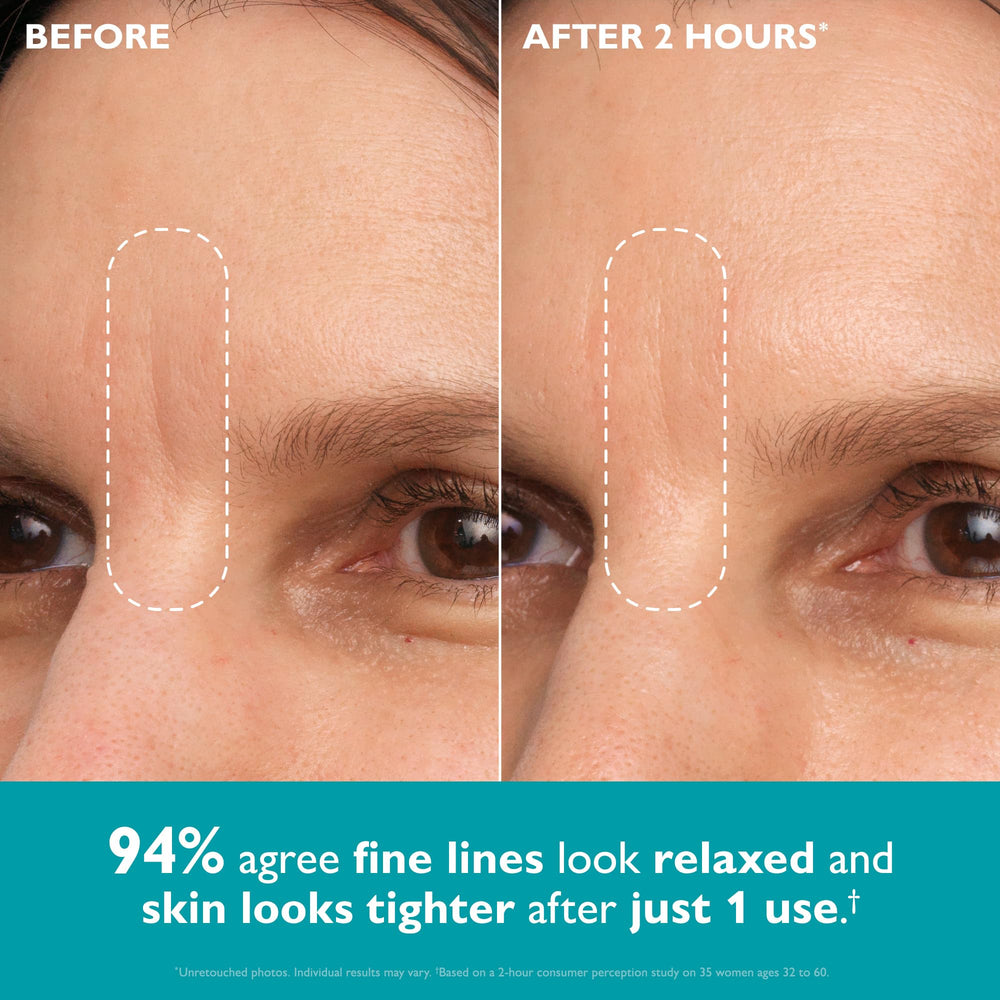 Peter Thomas Roth showing both oval and wing tape shapes for targeting