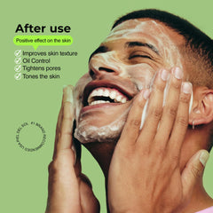 Piel del Sol foam being applied to face delivering targeted acne care