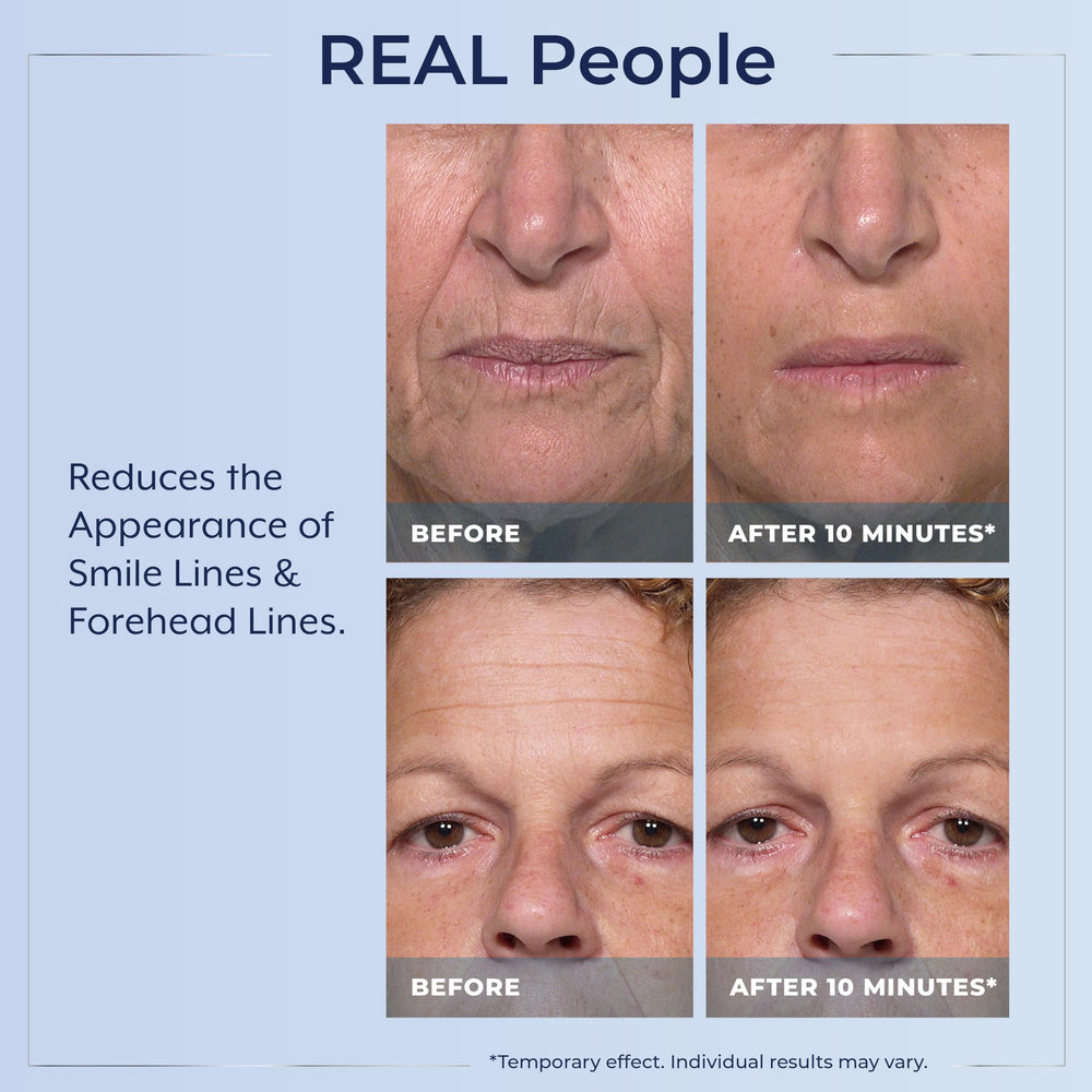 Plexaderm being applied under eye demonstrating instant lift