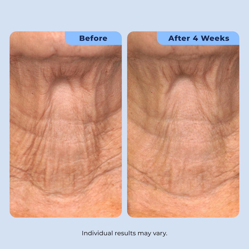 Plexaderm size and scale with hand for portion guidance and travel convenience