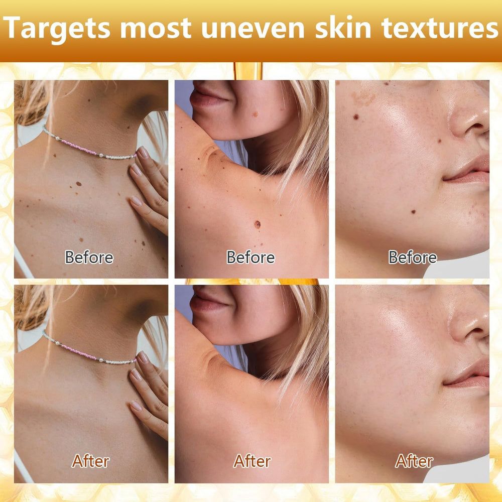 Plresen bee venom spray being applied to neck illustrating easy full-coverage use