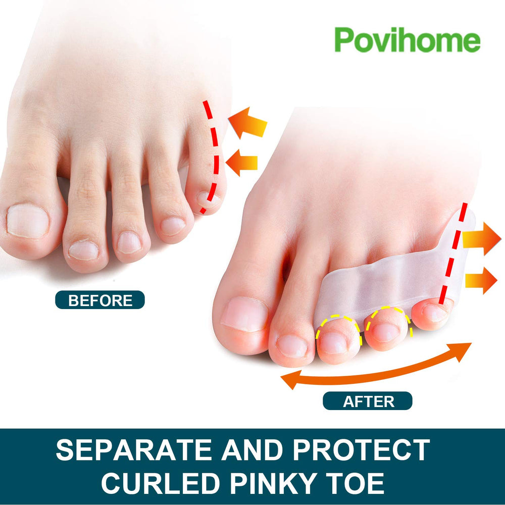Povihome three-hole fit detail showing secure hold for little toe