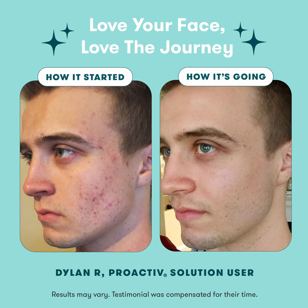 Proactiv repairing treatment applied to a spot to speed visible improvement