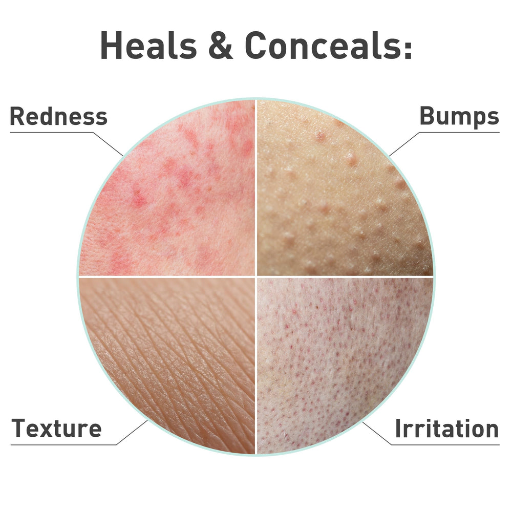 PROcure model wearing mask mid-treatment showing calming fit and instant cooling effect for redness