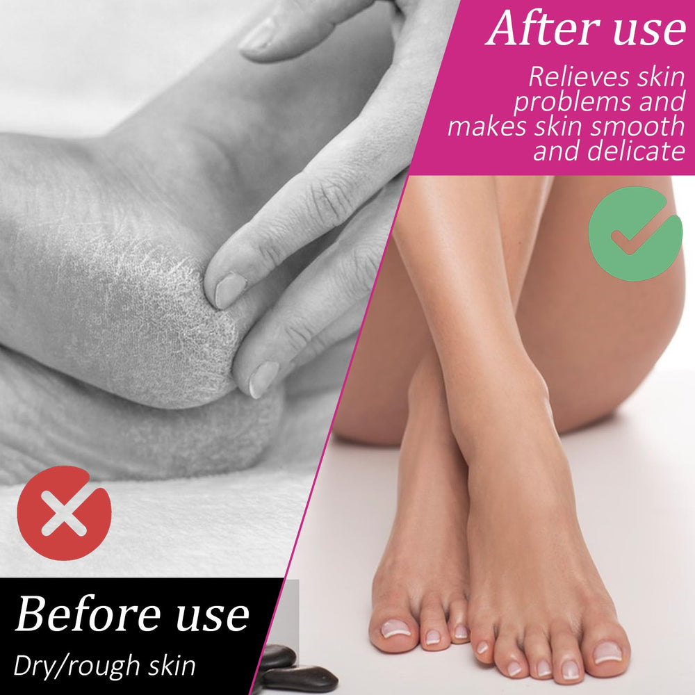 Psiriol open pair showing interior cotton lining for maximum lotion contact
