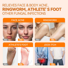 QualiLife persimmon and tea tree ingredients staged to show natural cleansing benefits