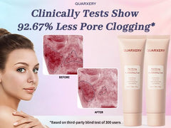 QUARXERY used on shoulder to clear body pores and smooth skin