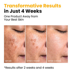 QUIA Beauty before and after comparison illustrating improved texture