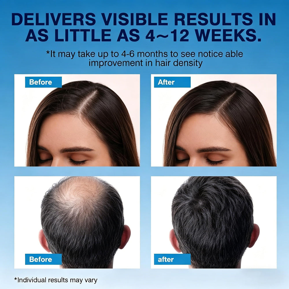Quilom foam applied to thinning scalp showing targeted coverage and non-greasy finish