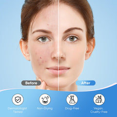 QUSTERE star patch on cheek at night reducing redness while sleeping