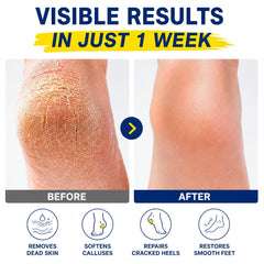 QVCQ label close-up highlighting 60% urea and 2% salicylic acid concentrations