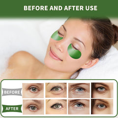 Qyiywim refrigerated patches illustrating extra cooling for puffiness relief