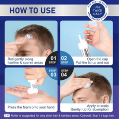 RDVHDLW foam being applied to scalp demonstrating easy application