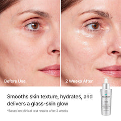 REJURAN ampoule held in hand to show true size and travel-friendly benefit