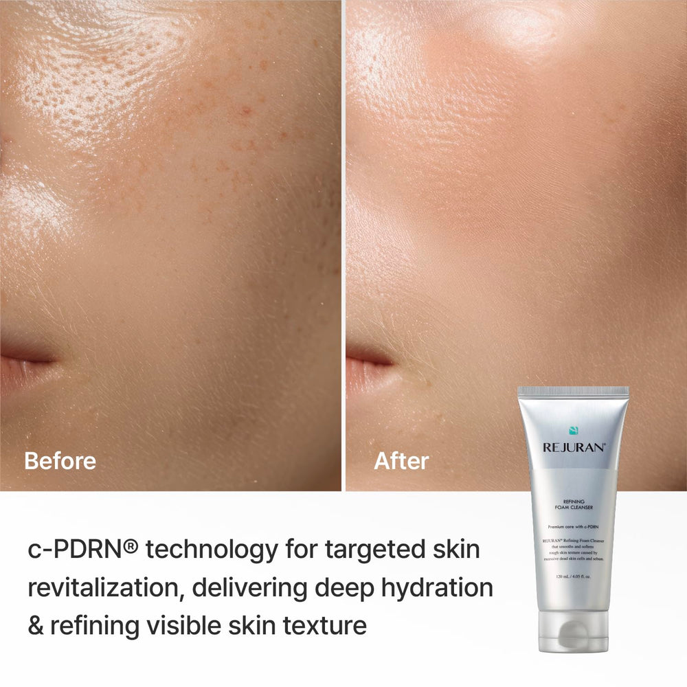 REJURAN label and ingredient list emphasizing c-PDRN and hyaluronic aid