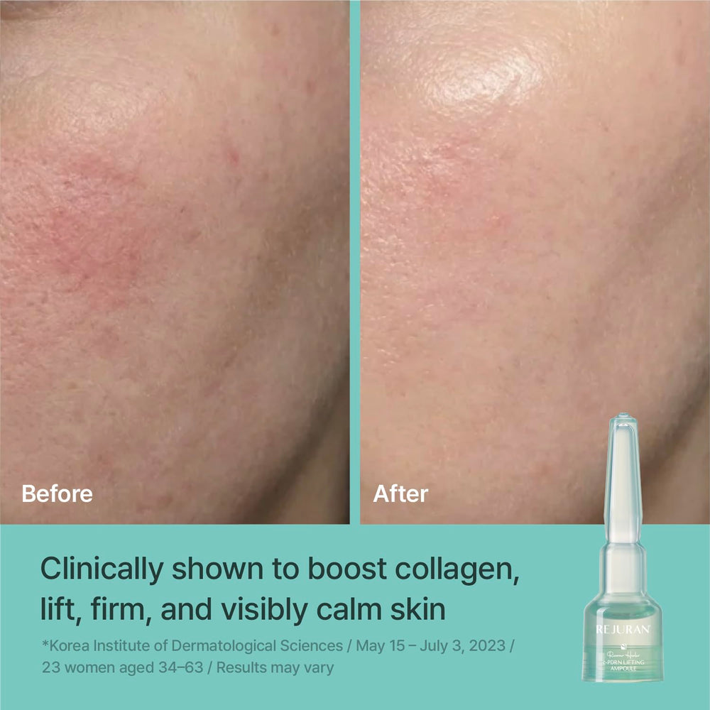 REJURAN serum texture on skin closeup showing fast absorption and hydrated finish
