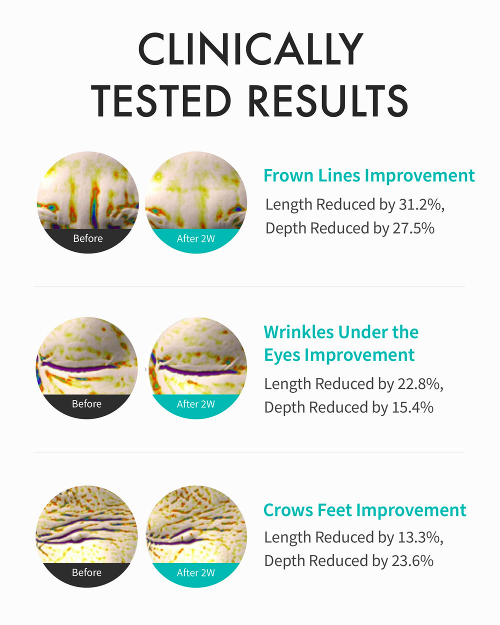REJURAN ingredient visual c-PDRN emphasizing regenerative support