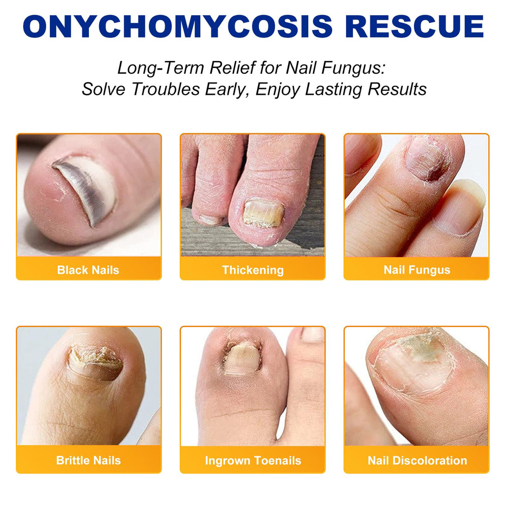 ReliCo patch applied on toenail for targeted overnight treatment