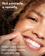 Remedy Science patch hidden under light makeup for near-invisible coverage