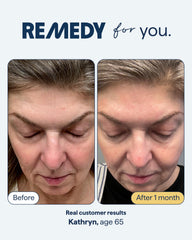 Remedy Science pump dispensing pea-sized dose for controlled use