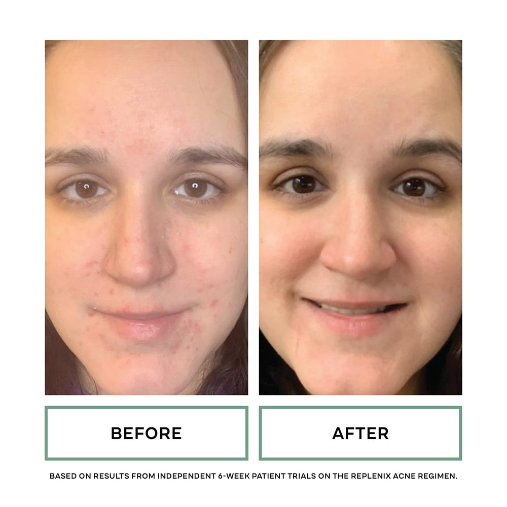 Replenix ingredients label close-up showing glycolic and salicylic acid strengths benefit