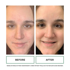 Replenix ingredients label close-up showing glycolic and salicylic acid strengths benefit