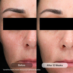 Revision Skincare texture closeup showing lightweight serum consistency for fast absorption benefit