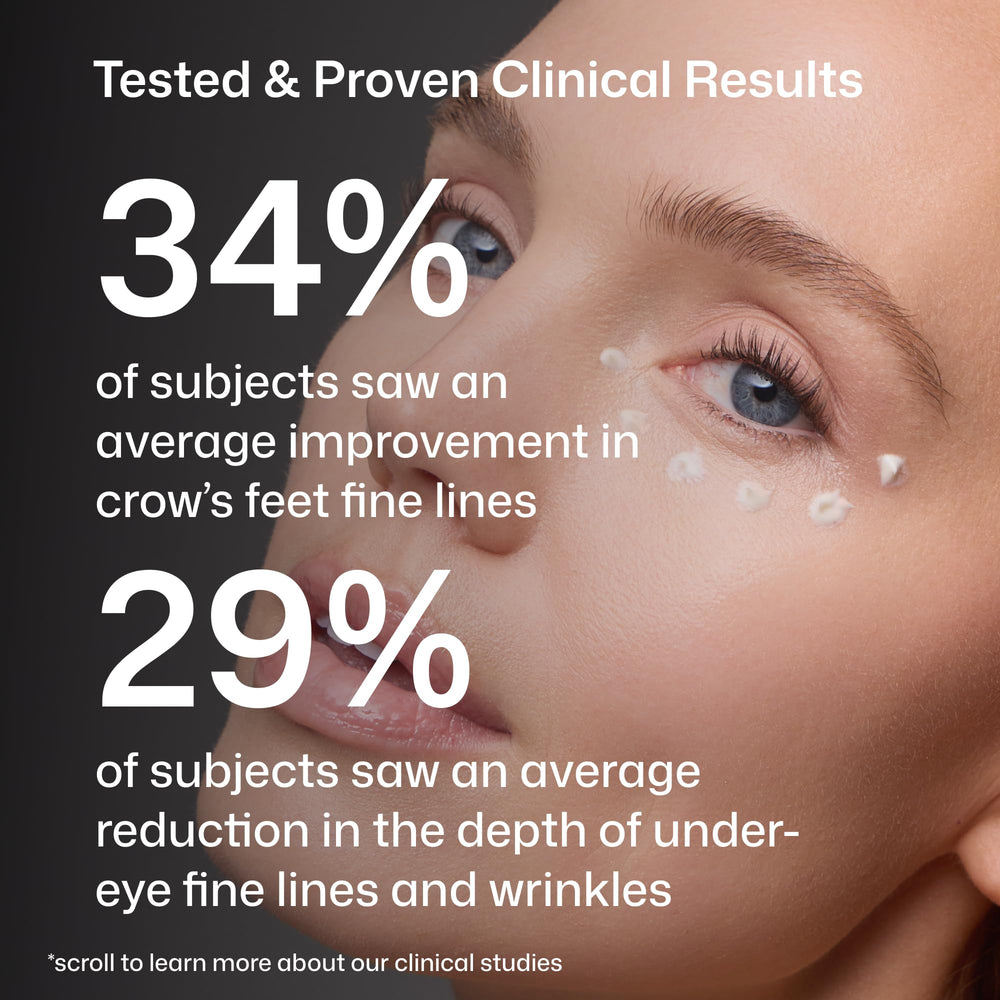 Revision Skincare D·E·J Eye Cream under-eye application showing moisturized, smoother under-eye skin