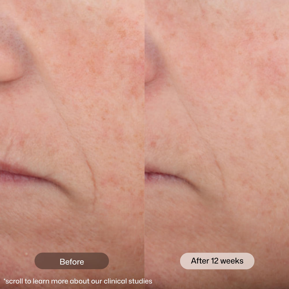 Revision Skincare cream texture close-up showing smooth, blendable formula