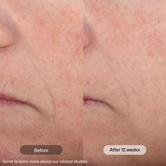 Revision Skincare cream texture close-up showing smooth, blendable formula