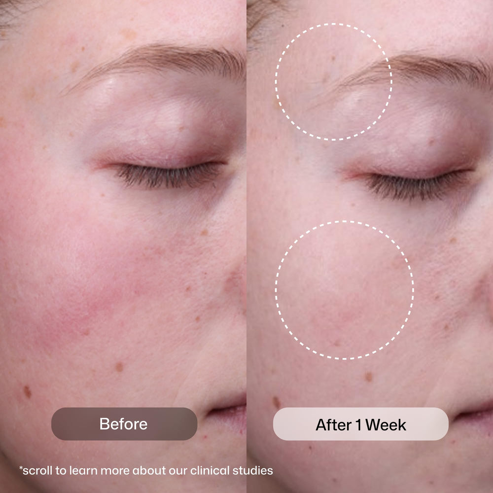 Revision Skincare serum drops on hand demonstrating lightweight, fast-absorbing texture