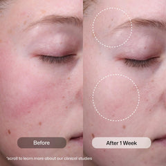 Revision Skincare serum drops on hand demonstrating lightweight, fast-absorbing texture