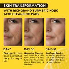 RICHGRAND close-up of pad texture demonstrating gentle exfoliation